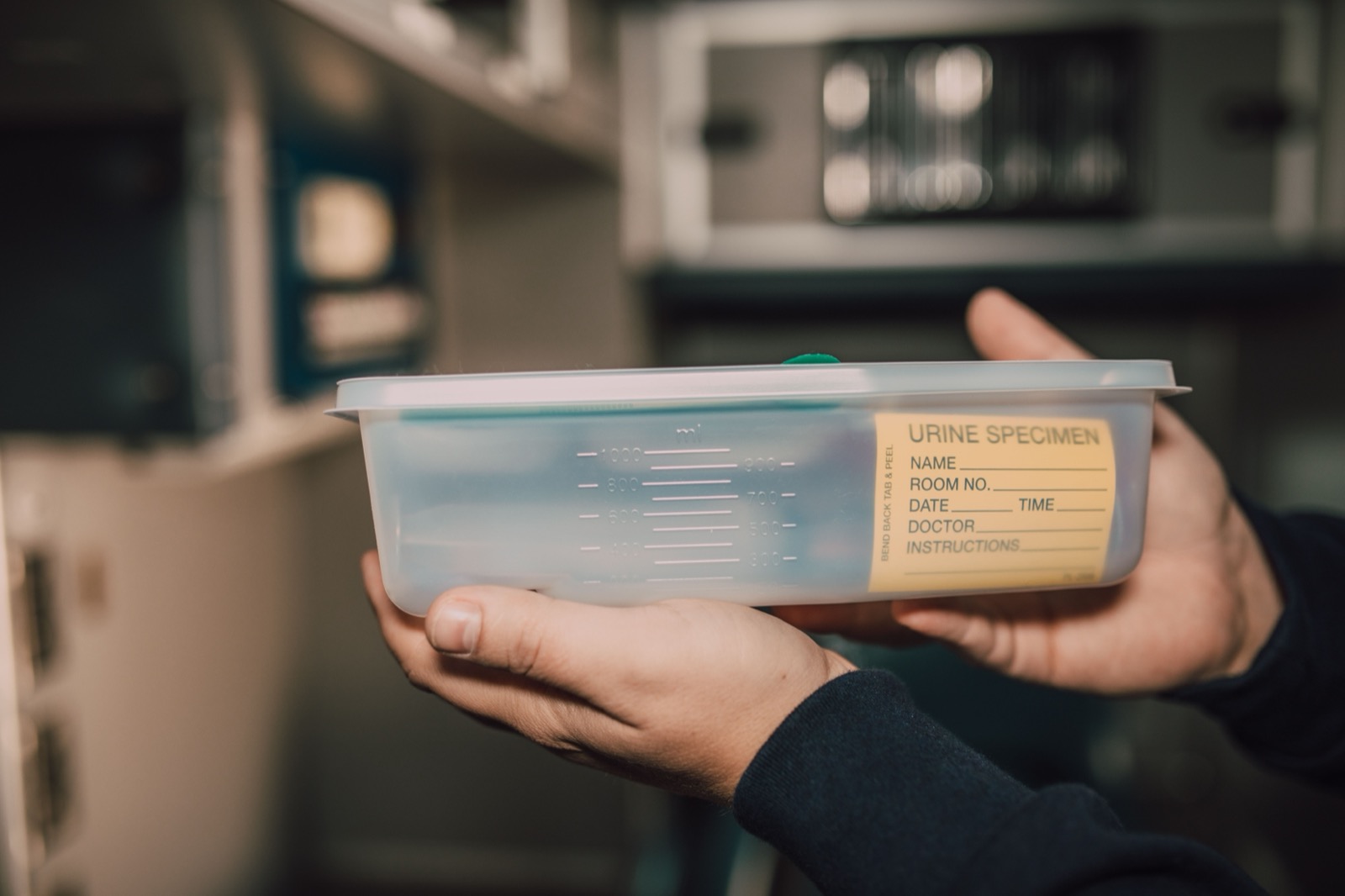 Laborprobe im Testbecher – Abstinenznachweis Haaranalyse Urinscreening
