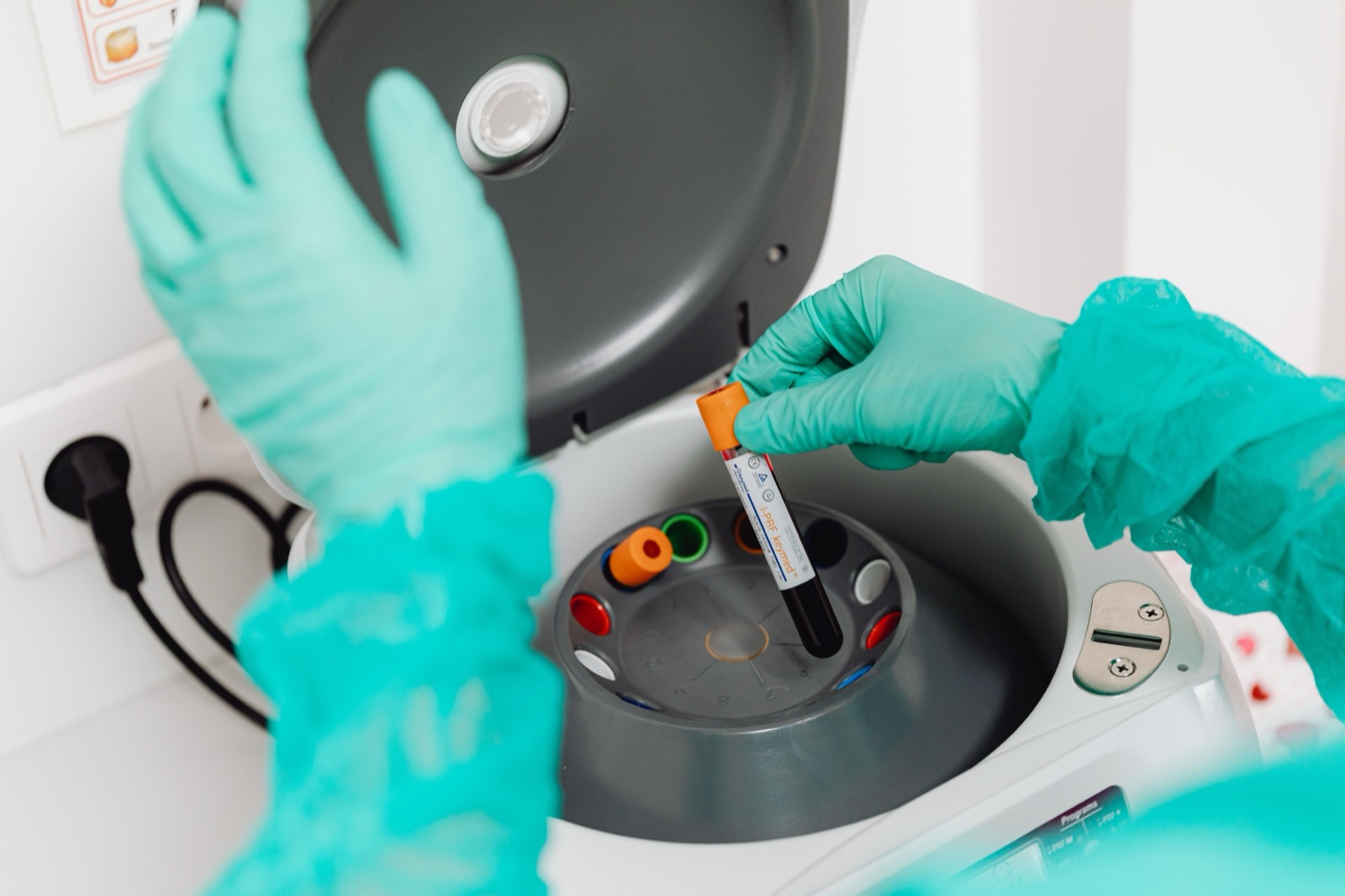 Labortechnikerin analysiert eine Blutprobe für den CTU-Abstinenznachweis